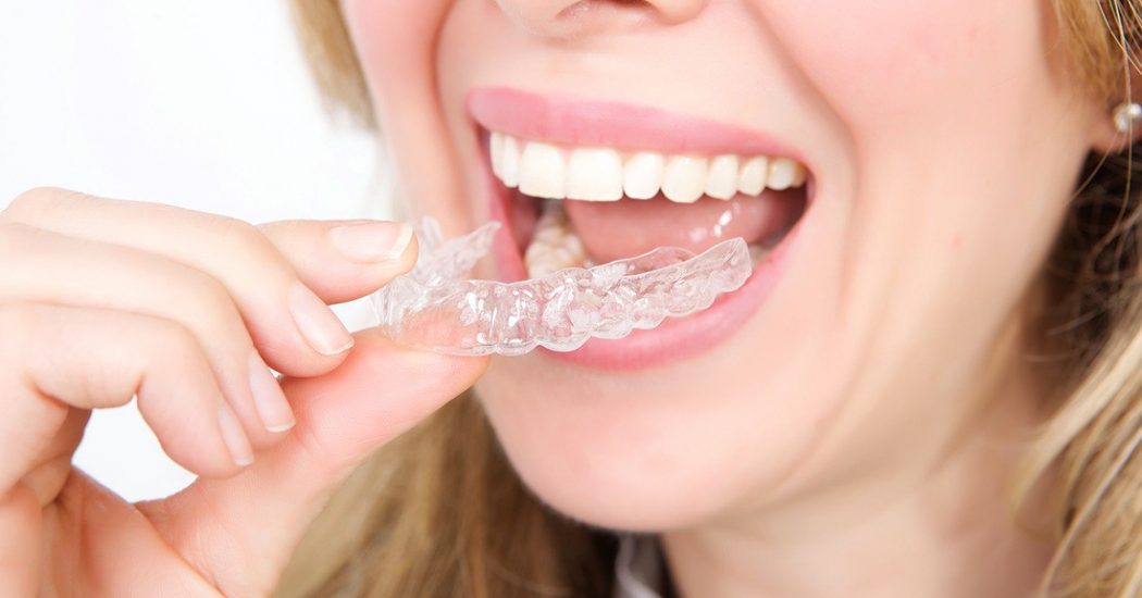 Understanding The Significant Advantages Of Invisalign