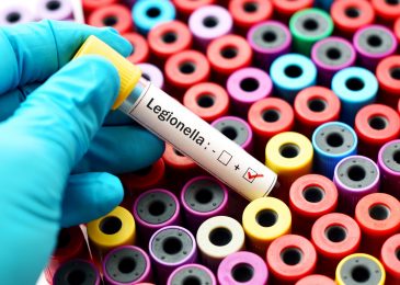 A Guide To Learning About Legionnaires & Legionella Control