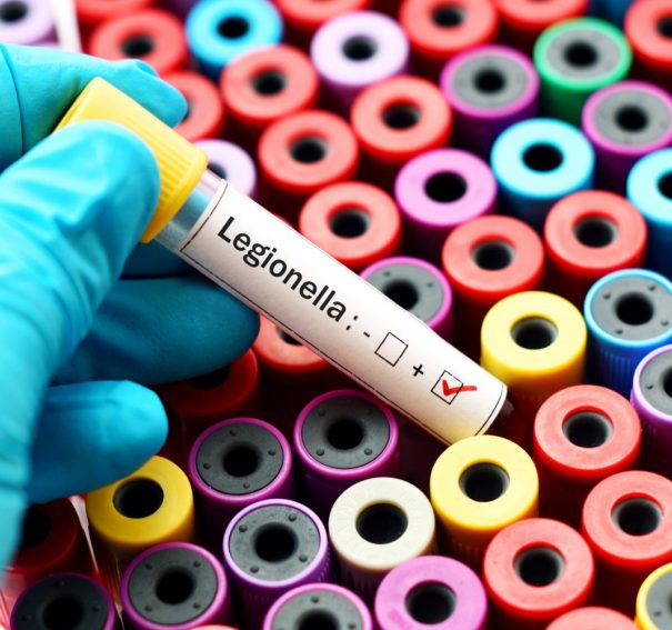 A Guide To Learning About Legionnaires & Legionella Control