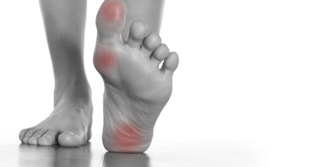 How Plantar Fasciitis Insoles Are Beneficial?