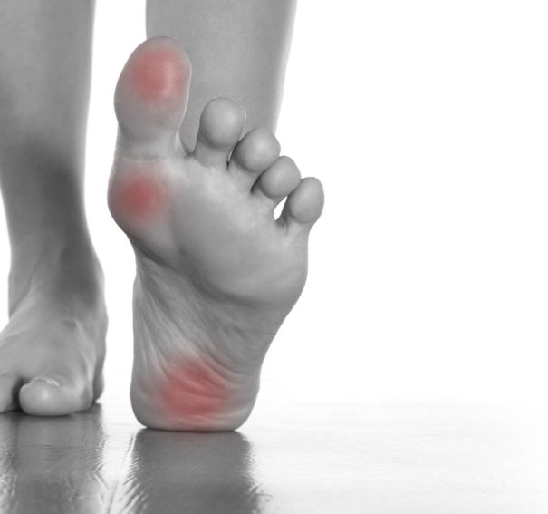 How Plantar Fasciitis Insoles Are Beneficial?
